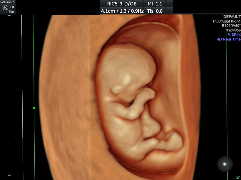 HD Ultrasound | My Baby Debut! | 3D 4D HD Elective Ultrasound | Chicago, IL